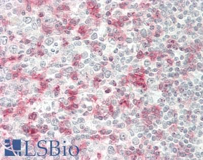 PathPlus™ PDCD1 / CD279 / PD-1 Antibody (clone 11B2)