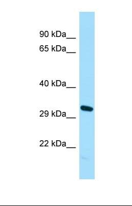 Polyclonal Rabbit anti-Human CDKL1 Antibody (N-Terminus, WB)