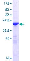 Human HPCAL1 / Hippocalcin-Like 1 Protein (Recombinant GST)