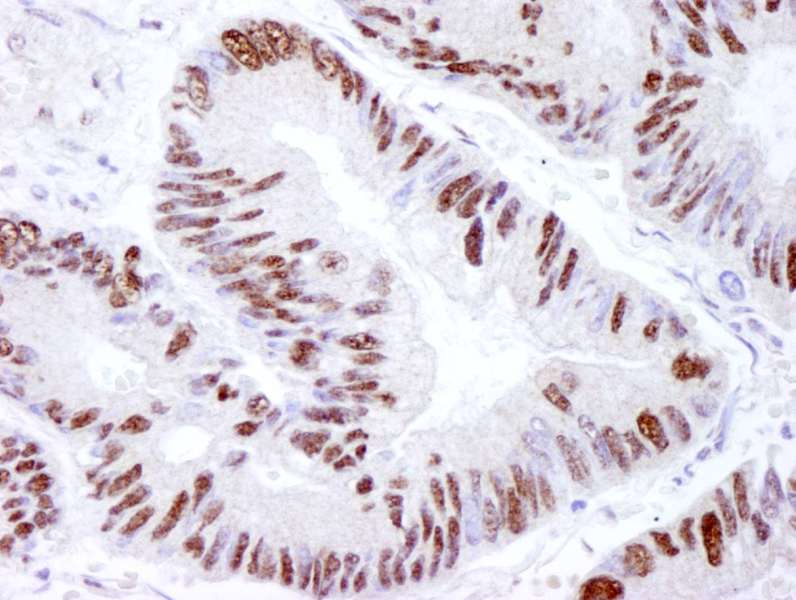 PRKDC / DNA-PKcs Antibody (aa2100-2150)