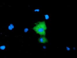Monoclonal Mouse anti-Human Alpha-Fetoprotein Antibody (clone OTI2E10, IF, WB)