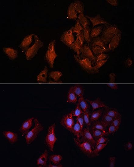 BAP1 Antibody