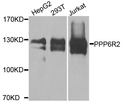 PPP6R2 / SAPS2 Antibody
