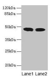 IHC-plus™ ACADL Antibody