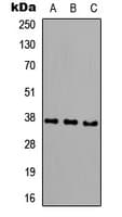 CTSK / Cathepsin K Antibody (Internal)