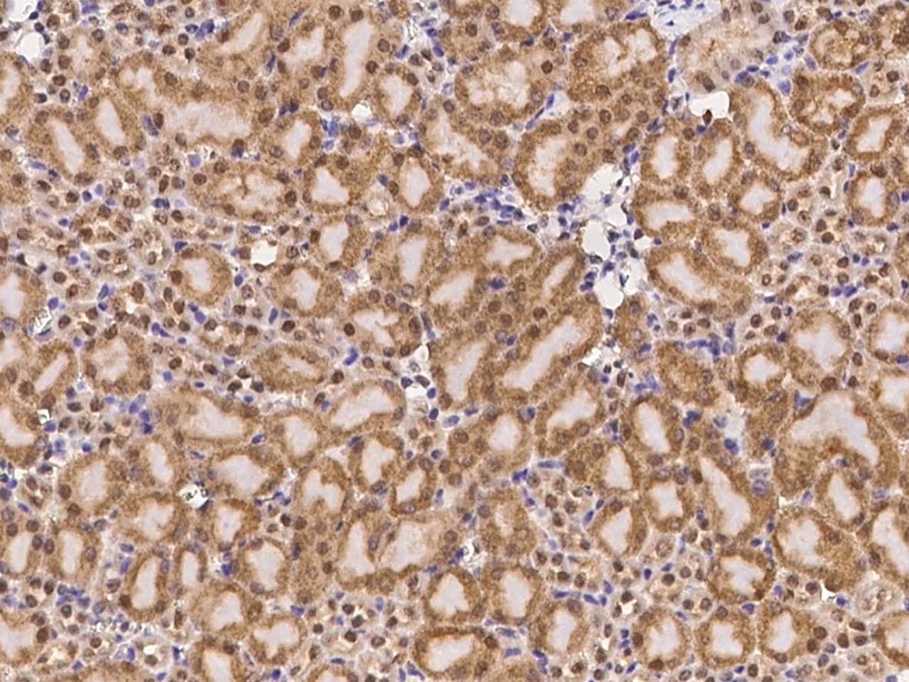 PTPN2 / TC-PTP Antibody (Preservative Free)