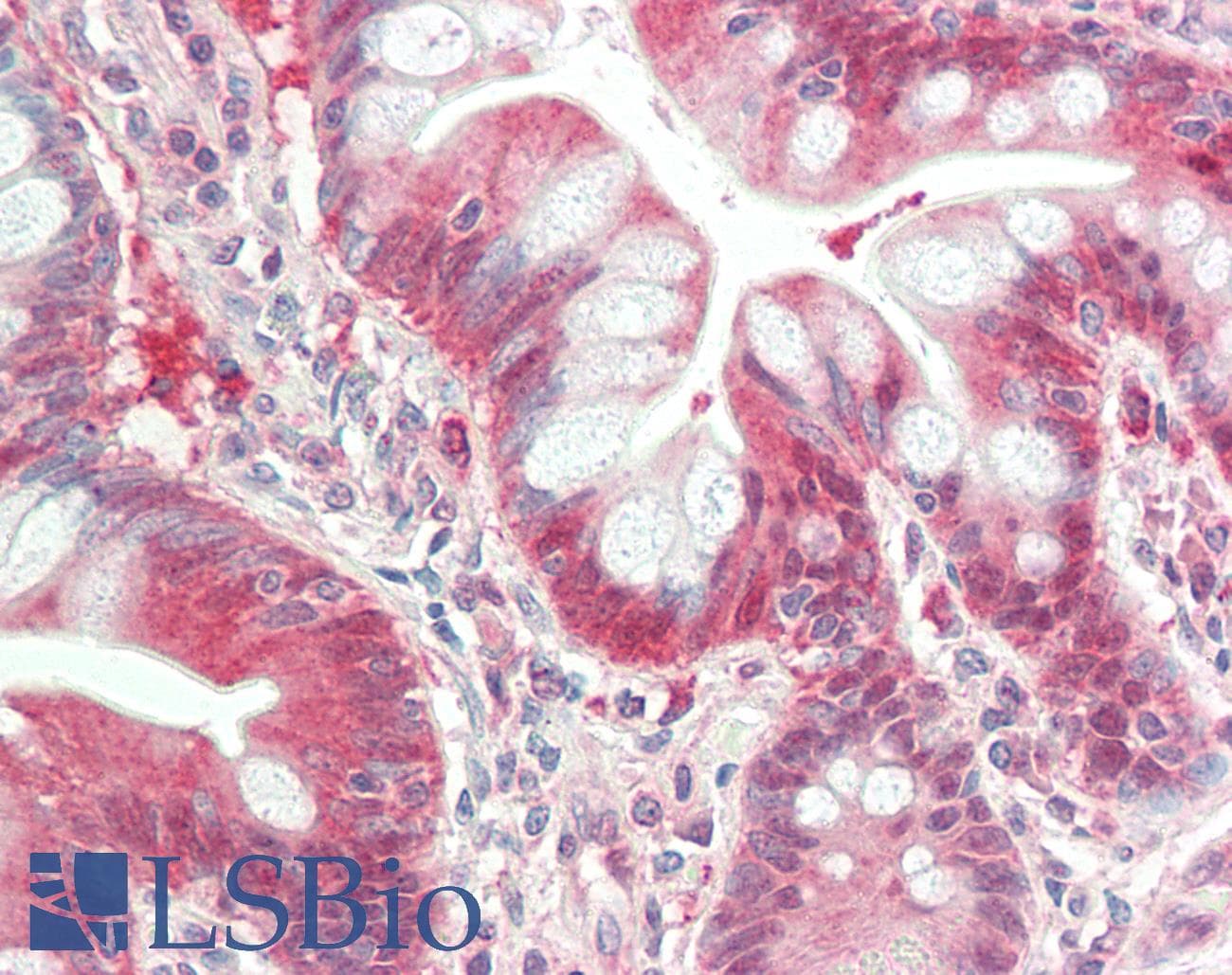 IHC-plus™ IRAK4 / IRAK-4 Antibody (clone 2H9)