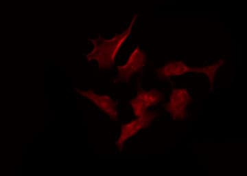 KCNV2 / Kv11.1 Antibody