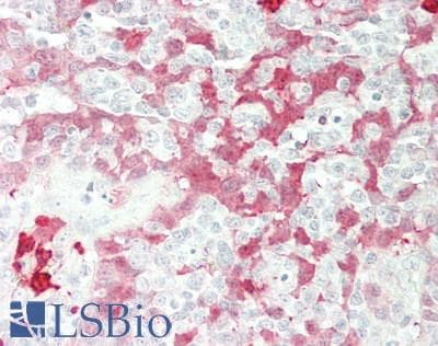 IHC-plus™ S100A8 / MRP8 Antibody (aa 1-93)