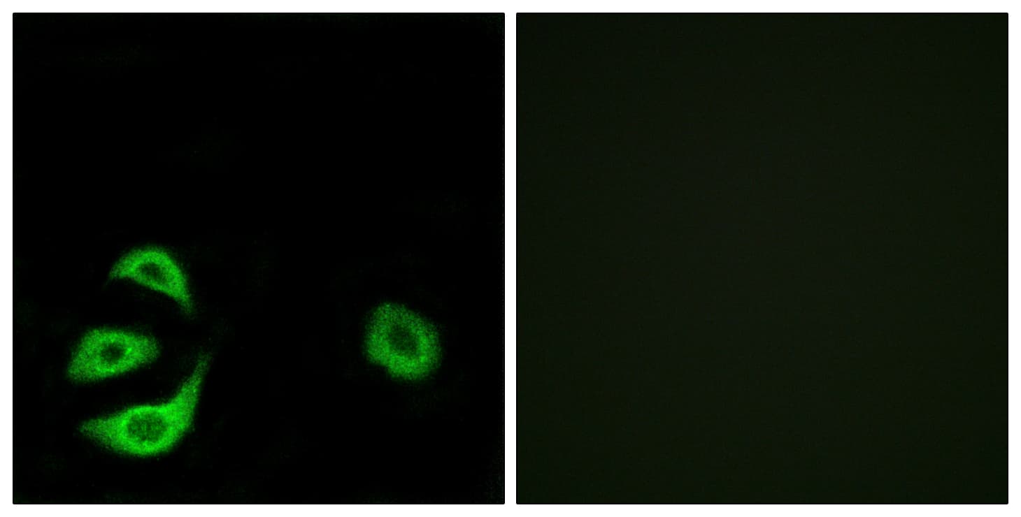 IHC-plus™ ACOT8 Antibody (aa131-180)