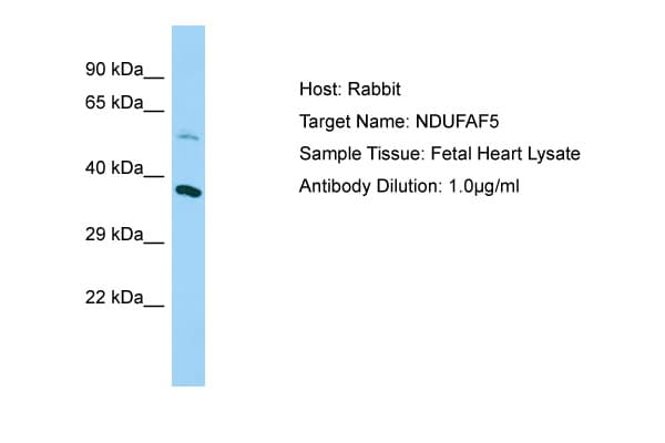 NDUFAF5 Antibody (aa43-92)