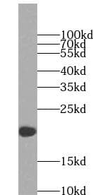IL2 Antibody