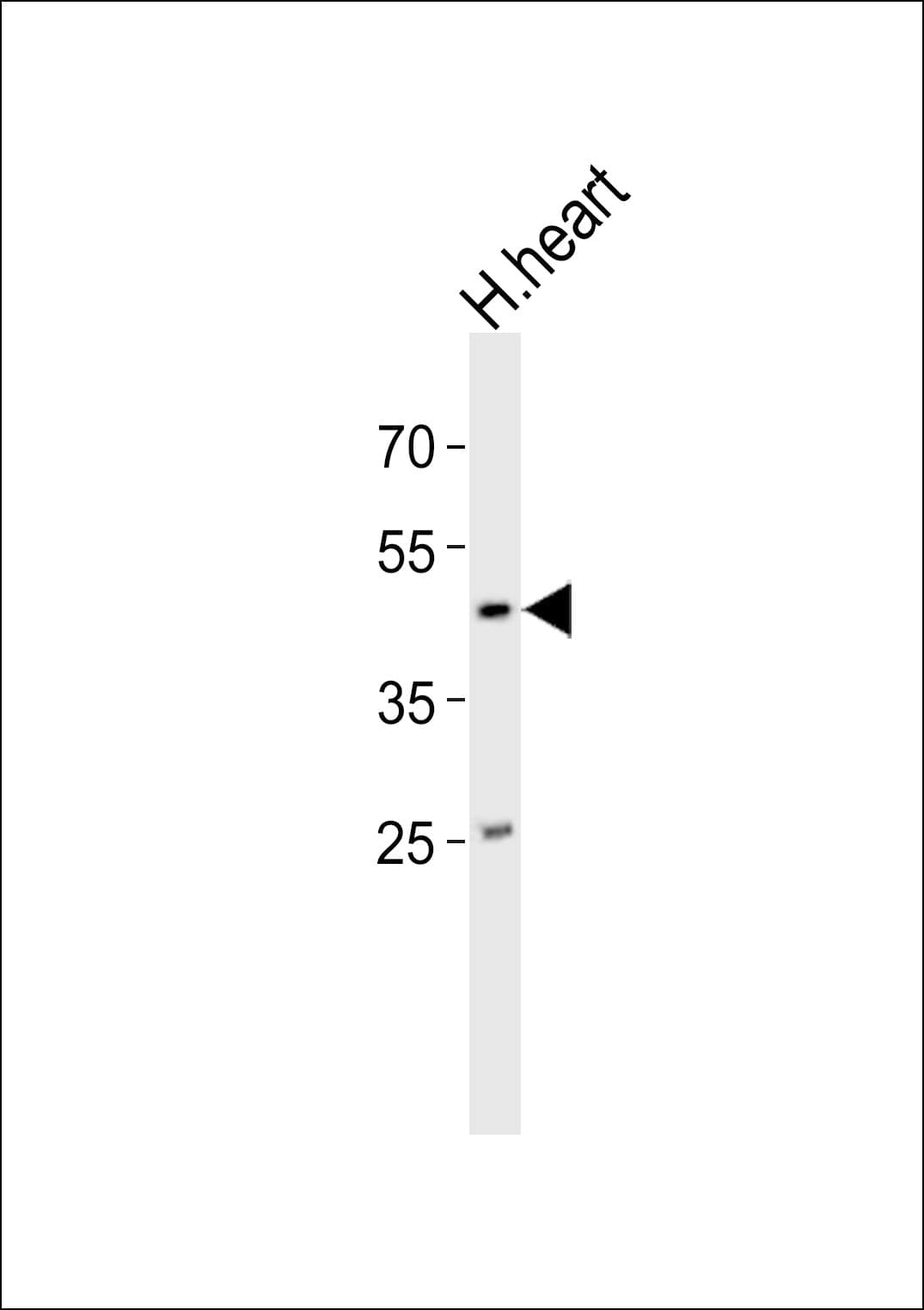 NDN / Necdin Antibody (aa75-109)