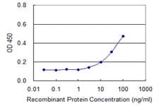Monoclonal Mouse anti-Human Neurofibromin / NF1 Antibody (clone 2D1, WB)