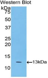 BAFF Receptor / CD268 Antibody (aa96-184)