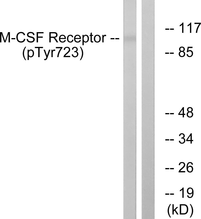 Polyclonal Rabbit anti-Human CSF1R / CD115 / FMS Antibody (phospho-Tyr723, IHC, WB)