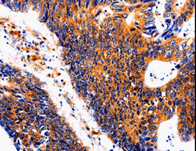Polyclonal Rabbit anti-Human IL18BP Antibody (IHC)