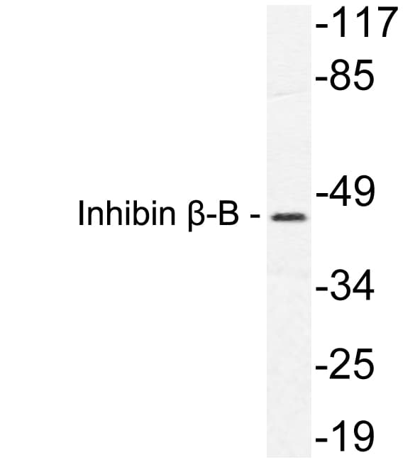 Polyclonal Rabbit anti-Human INHBB / Inhibin Beta B Antibody (aa75-124, WB)