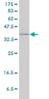 RAD51C Antibody (clone 3F3-5C6)