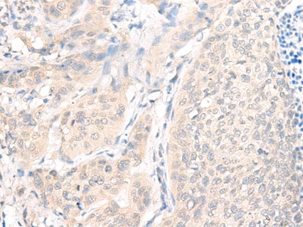Polyclonal Rabbit anti-Human AOAH / Acyloxyacyl Hydrolase Antibody (IHC)