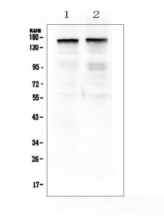 THBS2 / Thrombospondin 2 Antibody