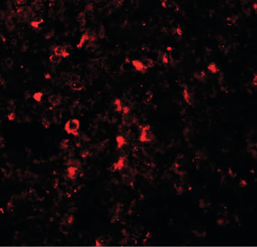 SLC39A5 / ZIP5 Antibody