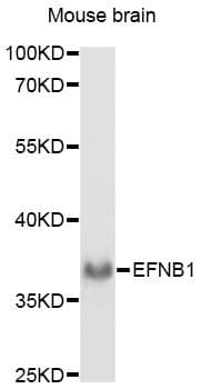 Polyclonal Rabbit anti-Human EFNB1 / Ephrin B1 Antibody (WB)