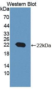 PPIB / Cyclophilin B Antibody (aa47-216, Biotin)