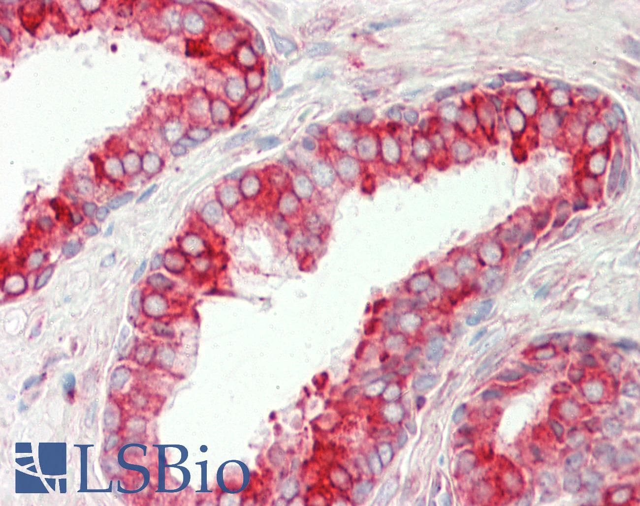 IHC-plus™ Polyclonal Rabbit anti-Human PDIA4 / ERP72 Antibody (aa9-37, IHC, WB)