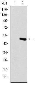 Monoclonal Mouse anti-Human TNNI2 Antibody (clone 2F12A8, IHC, WB)