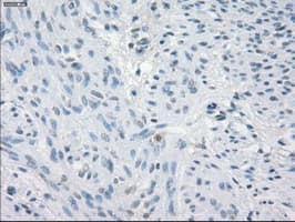 CD32A Antibody (clone OTI6H7)
