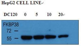 FKBP38 / FKBP8 Antibody (aa199-226)