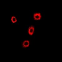 COPB2 / Beta-COP Antibody