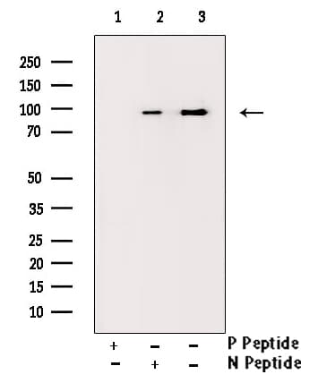 Polyclonal Rabbit anti-Human PR / Progesterone Receptor Antibody (phospho-Ser294, IF, WB)