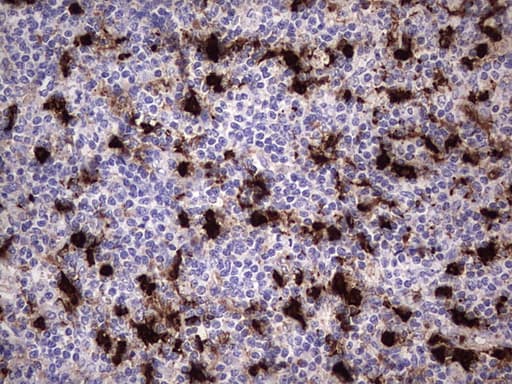 S100A9 / MRP14 Antibody (clone OTI2C5)