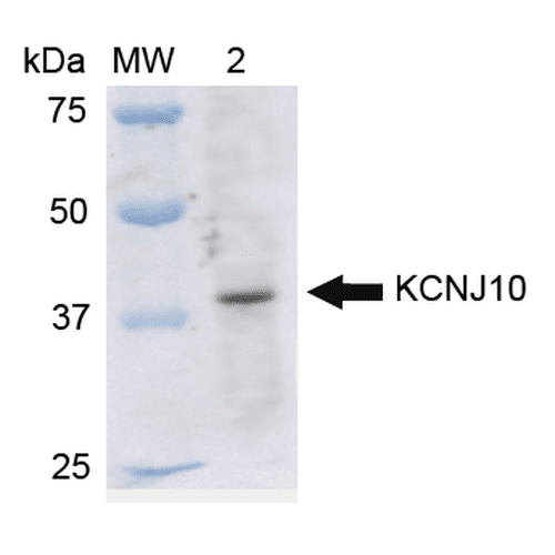 KCNJ10 / SESAME / KIR4.1 Antibody (APC)