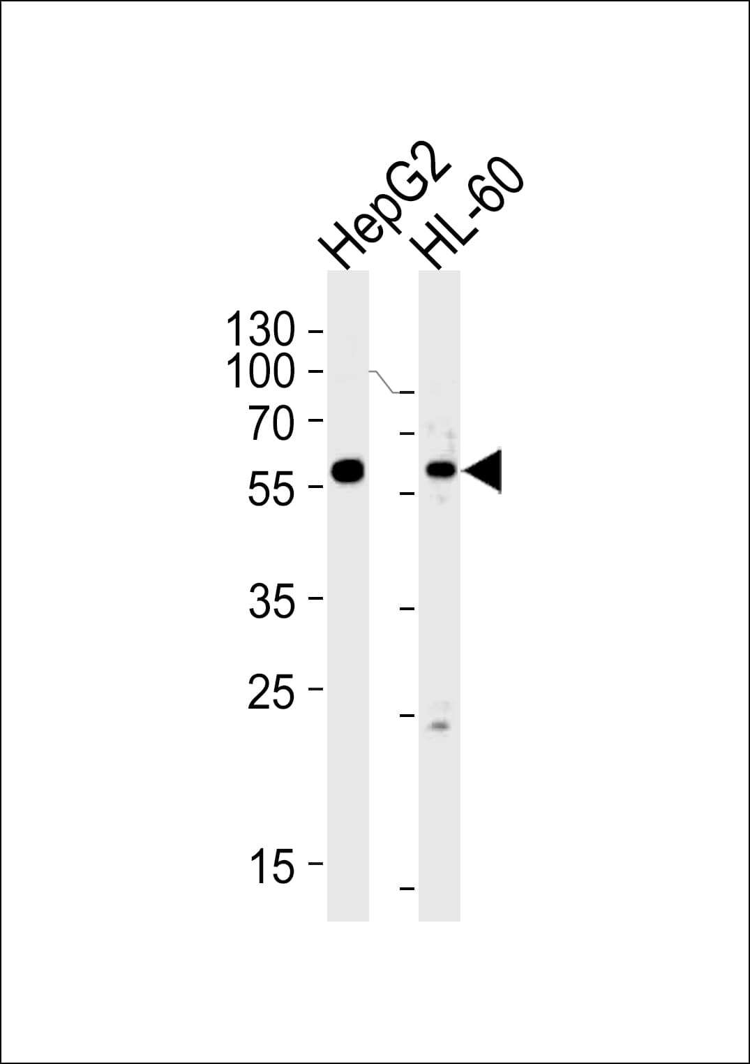 Polyclonal Rabbit anti-Human FANCC Antibody (aa527-555, IHC, IF, WB)