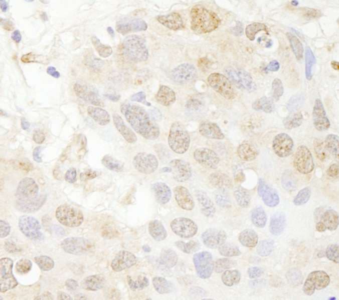 SETD7 / SET7 Antibody (aa316-366)