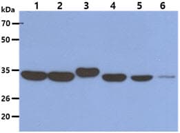 AIMP1 / EMAP II Antibody (clone AT6D10)