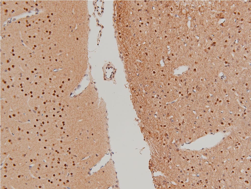 LIMK1 / LIMK Antibody (phospho-Thr508)