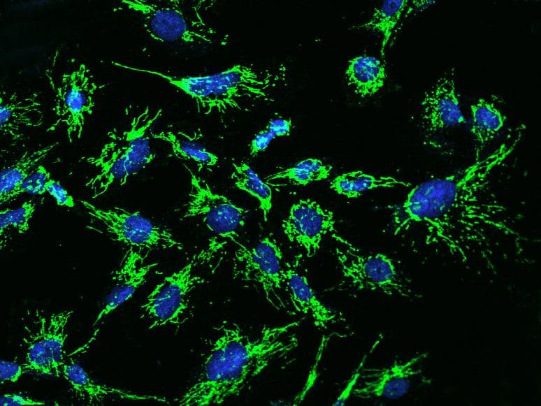 Polyclonal Rabbit anti-Human MRPL12 Antibody (IHC, IF, WB)