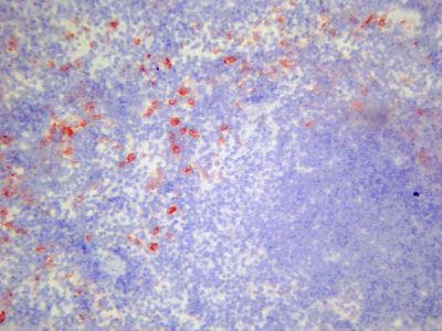 c-Kit / CD117 Antibody (clone ACK4)