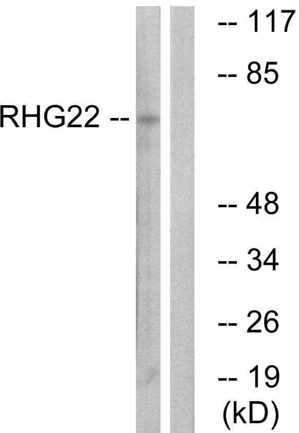 ARHGAP22 / RhoGAP2 Antibody