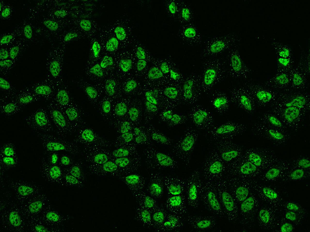 Polyclonal Rabbit anti-Human PPP4R2 Antibody (IF, WB)
