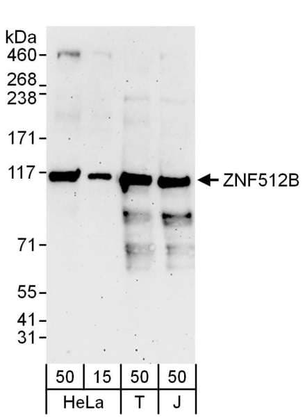 ZNF512B Antibody (aa450-500)