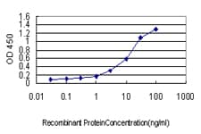 IHC-plus™ Monoclonal Mouse anti-Human CSE1L Antibody (clone 3F8, IHC, IF, WB)