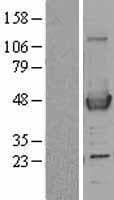 ACAA1 Protein (Over-Expression Lysate Myc-DDK (Flag))