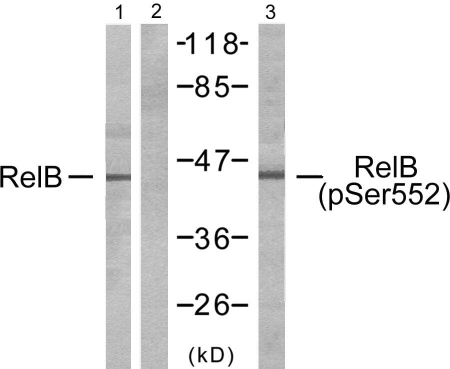 RELB Antibody (p552)