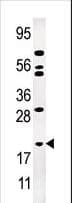 Polyclonal Rabbit anti-Human AK1 / Adenylate Kinase 1 Antibody (aa30-59, WB)