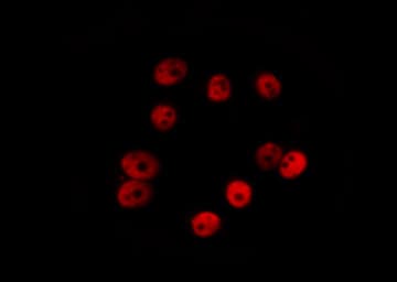 Vitamin D Receptor / VDR Antibody